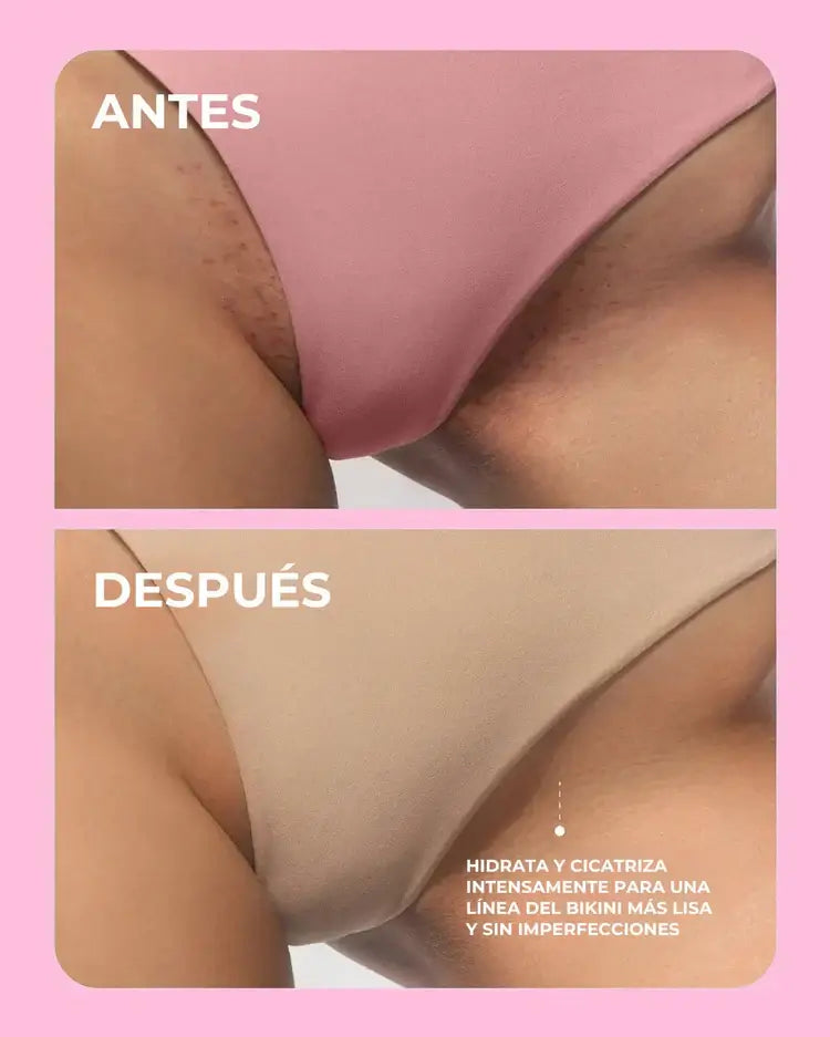 URO™ Probiótico Íntimo – Equilibrio, Frescura y Confianza