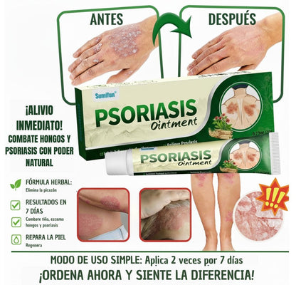 ✅ PSORIASIS™ |  Alivia la picazón y el enrojecimiento de la piel desde la primera aplicación ☀️