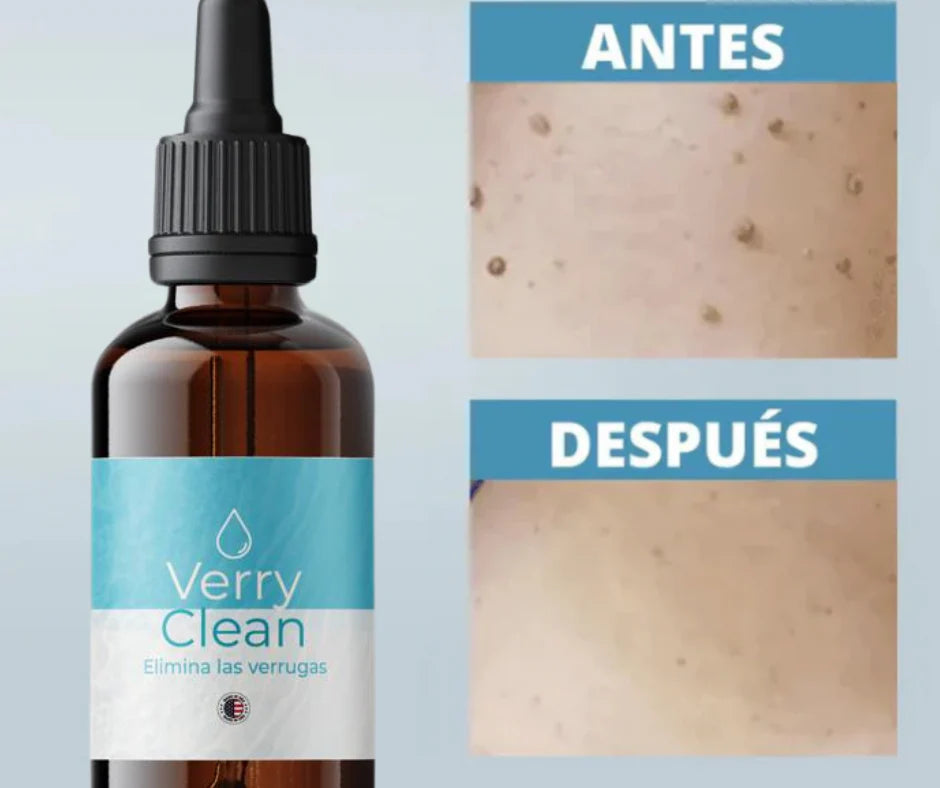 🍃VERRYCLEAN 🤩 ELIMINA VERRUGAS SIN DOLOR