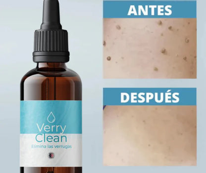 🍃VERRYCLEAN 🤩 ELIMINA VERRUGAS SIN DOLOR