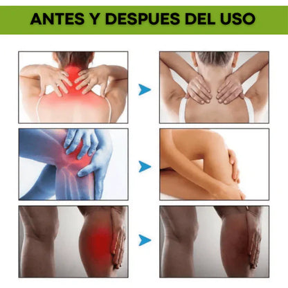 COMPRE 1 LLEVE 2 -Beevana Crema De veneno de abeja Multifuncional para dolores 🐝✨